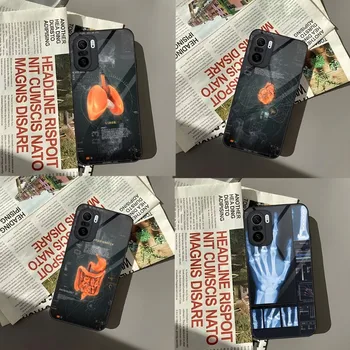 Чехол для телефона для радиологических органов человека Xiaomi 13 10 Redmi Note 11 8 11S Pro Poco M4 F3 X3 2023 Стеклянная крышка Изображение